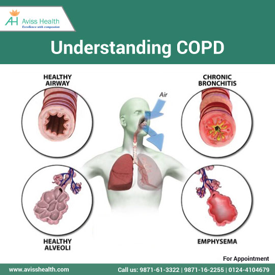 COPD Treatment – Aviss Health